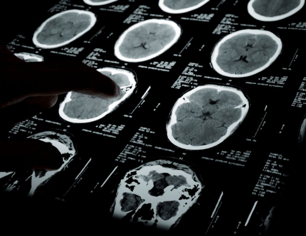 brain function